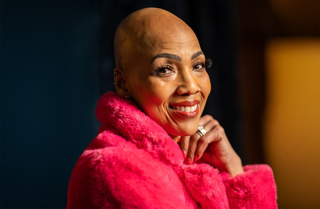 How Do You Keep a Wig on a Bald Head?