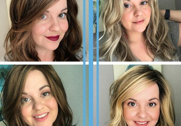 Losing Hair | My Hair Loss Story