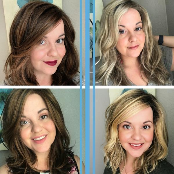 Losing Hair | My Hair Loss Story