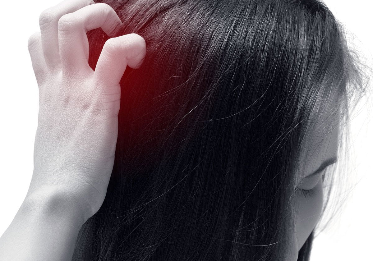 scalp pain causes